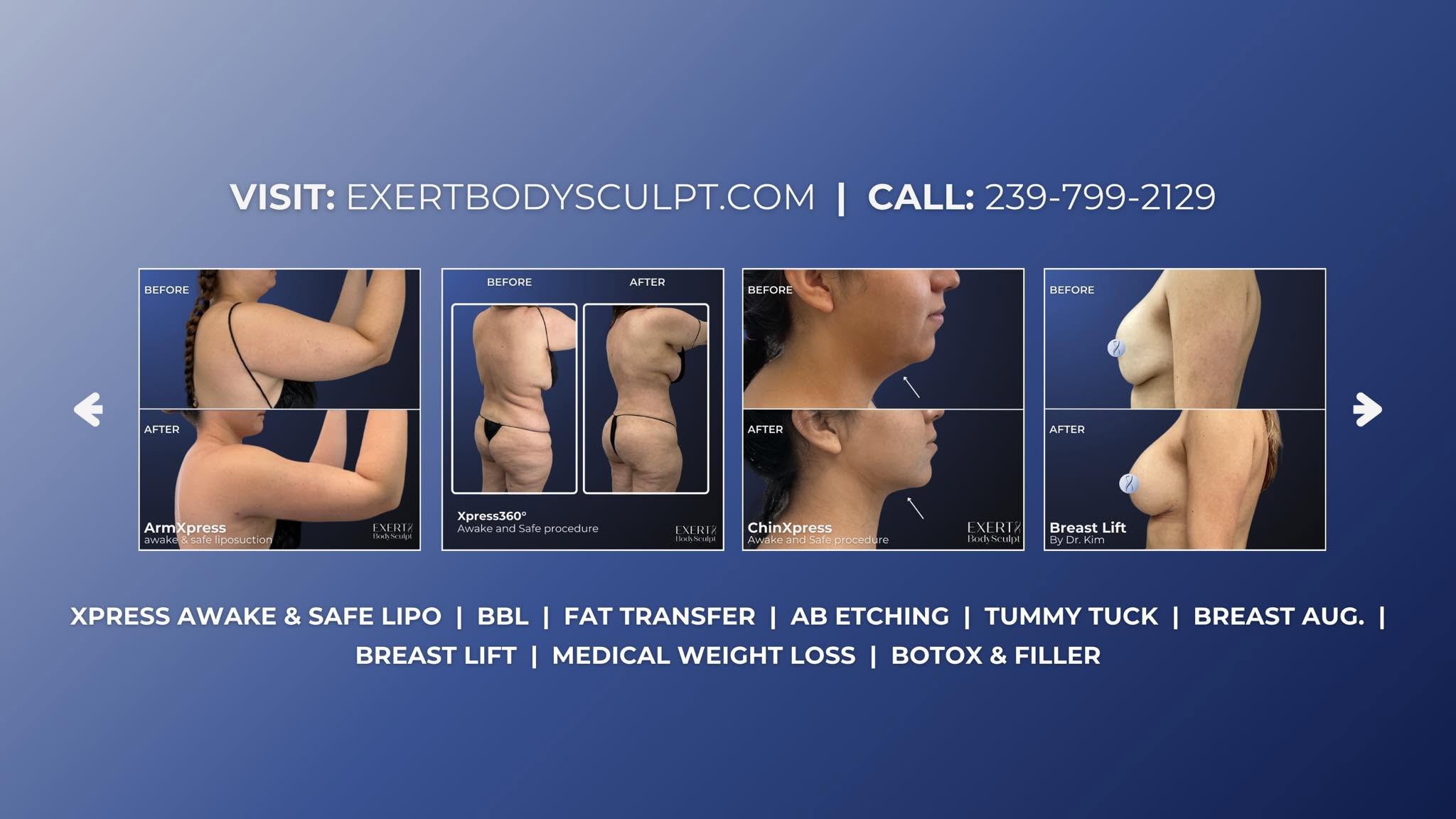 Exert BodySculpt - Business Photo